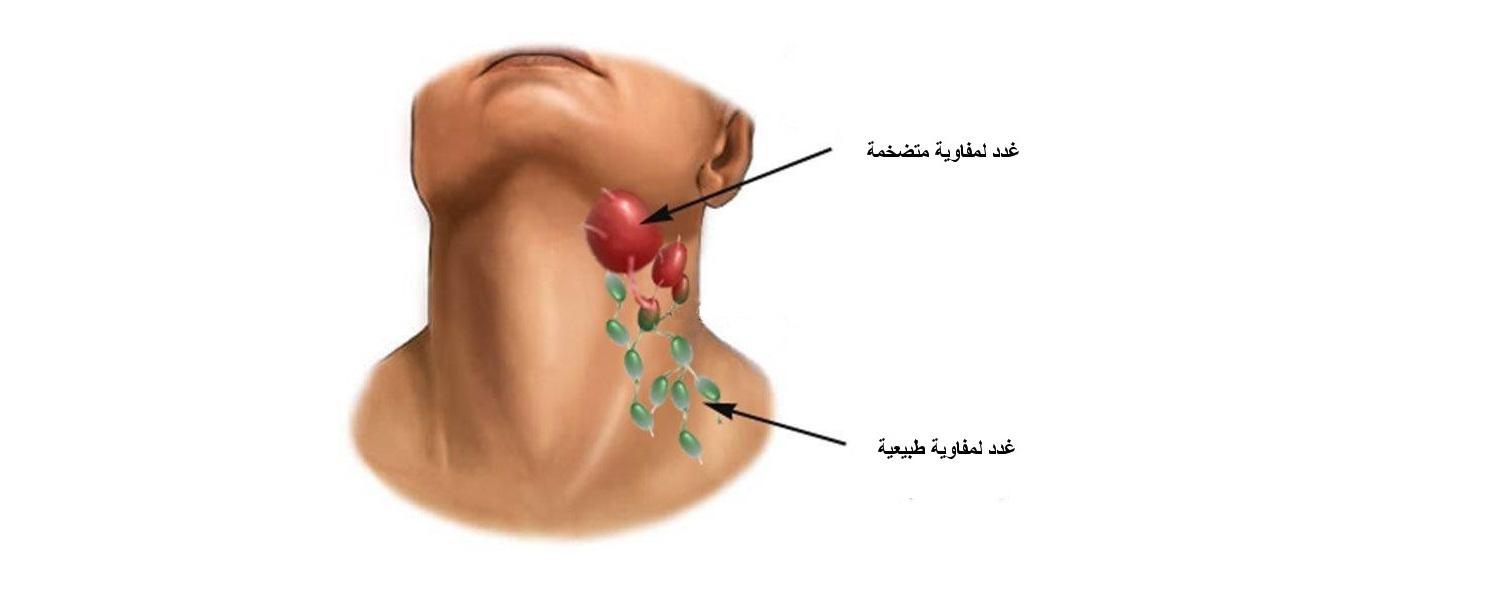 اي الغدد التالية توجد في العنق